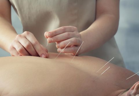 Island Acupuncture & Massage, Acupuncture